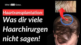 Empfängerbereich Haartransplantation Basic Wissen [upl. by Saraiya]