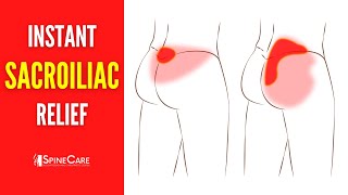 How to Fix Your Sacroiliac Joint Pain  STEPBYSTEP Guide [upl. by Necaj]