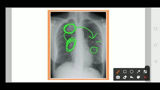 Practical medicine Xray Practice  3 [upl. by Kwasi463]