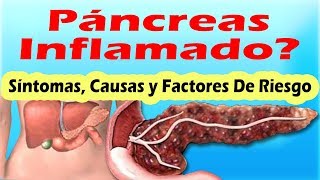 SINTOMAS DE PANCREATITIS AGUDA Y CRONICA Sintomas Del Pancreas Inflamado y Sus Causas [upl. by Cissej]