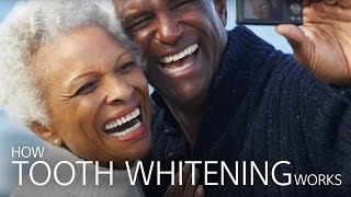 How Tooth Whitening Works [upl. by Ydeh]