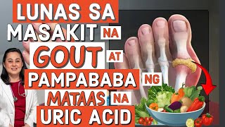 Lunas sa Masakit na Gout at Pampababa ng Mataas na Uric Acid  By Doc Liza RamosoOng [upl. by Alegnasor]