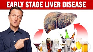 How Much Alcohol Would You Have to Drink Before Liver Damage [upl. by Annaxor]