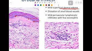 MSS pathology lab 1  part 1 [upl. by Peednus]