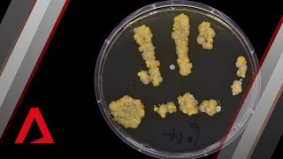 The bacteria living on your hands right now [upl. by Ecam]