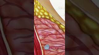 Understanding Incisional Breast Biopsy 🎗️ PreOp BreastHealth Shorts  PreOp® Patient Education 1 [upl. by Anaujahs]