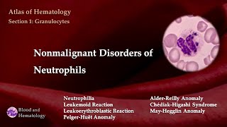 Nonmalignant Disorders of Neutrophils [upl. by Adnarrim542]