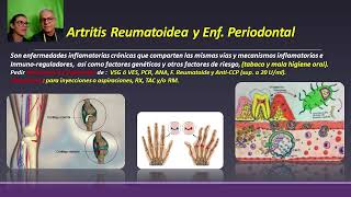 Artritis Reumat y Enf Periodontal [upl. by Early]