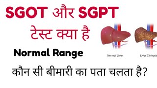 SGOT Blood Test  SGPT Blood Test  ALT  AST  SGOT amp SGPT Test Normal RangeMLTLabManual20 [upl. by Dilaw]