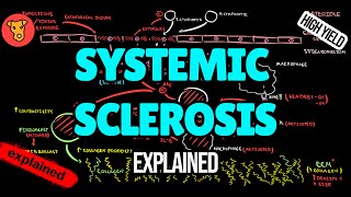 SCLERODERMA Systemic sclerosis Pathogenesis Diagnostic criteria Classification EULAR Treatment [upl. by Kraska448]