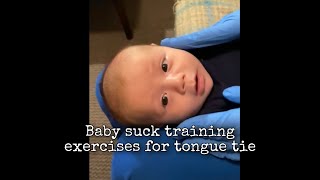 Baby Suck Training Exercises for Tongue Tie [upl. by Nichola]