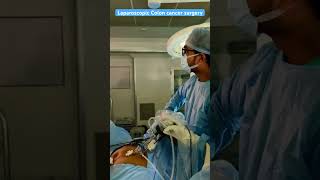 Laparoscopic colon cancer  dr Amit Acharya  Billroth Gastrosurgery centre Rajkot [upl. by Barr]