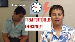 Effective Torticollis Treatment INCREDIBLE RESULTS [upl. by Ahsilem]