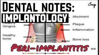 PERIIMPLANTITIS  LATE FAILURE OF IMPLANT  IMPLANTOLOGY  made easy [upl. by Annawot641]