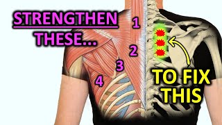 Strengthen These Muscles To Fix Rhomboid Pain [upl. by Adlih646]