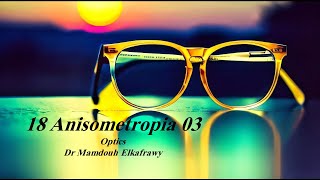 18 Anisometropia Part3 الكفراوي أوبتكس Elkafrawy optics Anisokonia Investigationamp Afocal lens [upl. by Aerdnaz868]