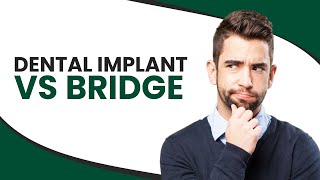 Dental Implant vs Bridge [upl. by Eednahs]