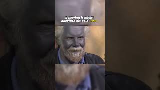 The Shocking Story of Paul Harrison How Colloidal Silver Turned Him Blue 😨 [upl. by Obara724]