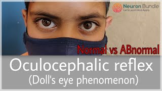 Doll’sEyeReflex Vestibulo Ocular reflex Normal amp ABnormal MADEEASY medicine neurology [upl. by Radu]