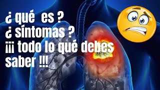 ASBESTOSIS SINTOMAS CAUSAS Y TRATAMIENTO [upl. by Nnairak]