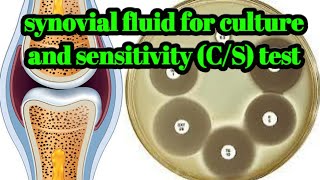 Synovial Fluid for Culture and Sensitivity CS test hindiurdu [upl. by Llahsram934]