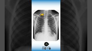 🔻 Anatomie VS Radiologie [upl. by Aicul63]