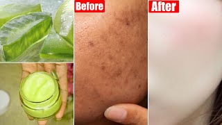 New Aloevera Skin Whitening Face CreamFor Dull Dark SkinPigmentation amp Dark SpotsGet Glowing Skin [upl. by Nadirehs934]