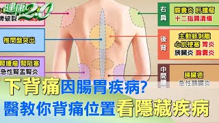 下背痛因腸胃疾病 醫教你背痛位置看隱藏疾病 健康20 [upl. by Ariek]