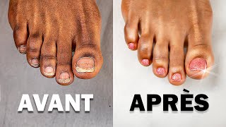 Tuto VERNIS SEMIPERMANENT Pieds  Comment faire une PÉDICURE Parfaite [upl. by Anawot]