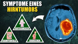 10 Symptome eines Hirntumors die du niemals ignorieren solltest [upl. by Tibbs743]