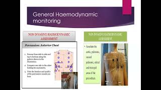 Haemodynamic monitoring Invasive Blood Pressure Measurement [upl. by Nerhe]