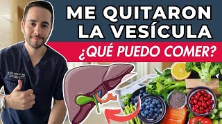 DIETA DESPUÉS DE CIRUGÍA DE VESÍCULA  Alimentos PROHIBIDOS  Cuáles DEBES comer [upl. by Eahs]