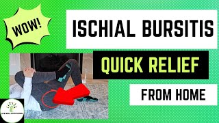 Ischial Bursitis  Sit Bone Pain  Live Well With Dr Mel [upl. by Inot]