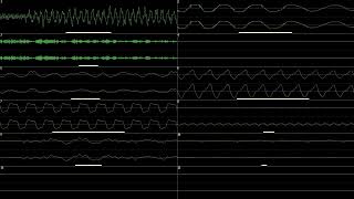 hipRepellantMold  BoomBox Level 1 Ext [upl. by Dremann545]