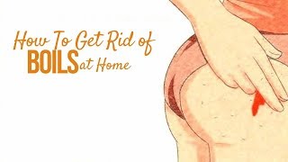 Home Remedies to Remove Boils on Butts [upl. by Enamrahs]