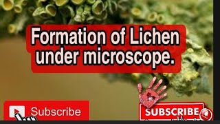 Formation Of Lichen Under Microscope [upl. by Artamas22]