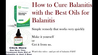 How to Cure Balanitis with the Best Oils for Balanitis [upl. by Dotti]