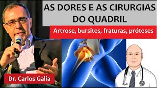 Dores no quadril causas e tratamentos com e sem cirurgia [upl. by Woodruff56]