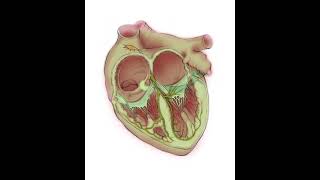 Ablation of AV node reentrant tachycardia AVNRT [upl. by Ynohtona432]