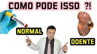 Doença RENAL com a Creatinina NORMAL  É Possível  🤔🤔🤔 [upl. by Dlareme]