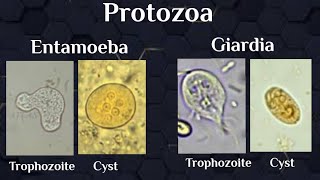 microscopical exam Protozoal trophozoites amp cysts [upl. by Noguchi]