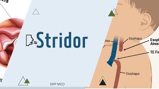 StridorDefinitionTypesMechanism [upl. by Ymeraj]