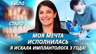 Имплантация верхних зубов Как мы поставили зубы за один день пока наша пациентка была во сне [upl. by Aisitel268]