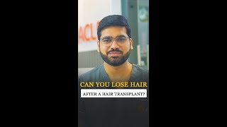 Can You Lose Hair After a Hair Transplant  Do Transplanted Hair Fall Out [upl. by Dibbell]