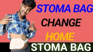 HOW TO CHANGE STOMA BAGSTOMA BAG CHANGESTOMA BAG CHANGE HOME STOMA BAG LEAKAGE PROBLEMHINDI ME [upl. by Hoffarth]