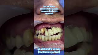 Porque no sería recomendable colocar implantes dentales con periodontitis  shortsvideo fypシ rd [upl. by Aloivaf]