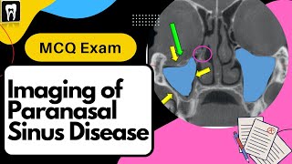 Oral Radiology Practice questions  Paranasal sinus disease imaging [upl. by Ramiah]