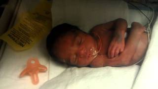 Baby Born at 30 weeks [upl. by Alta]