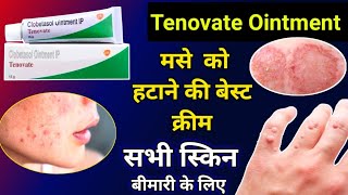 Tenovate Cream Uses In Hindi  स्किन की Fungal Infection के लिए जरूर ले  Full information [upl. by Reine]