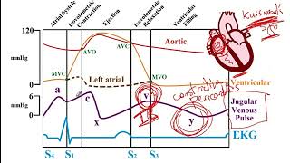 USMLE ACE Video 120 Wigger and FrankStarling Diagram [upl. by Ahsienad]